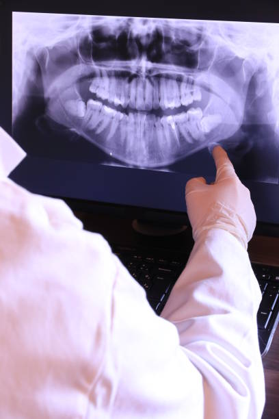 Best Emergency Denture Repair in Ashland, NE